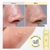 NOONI Snow Aqua Rice Ceramide Barrier Care Korean Cleansing Oil 6.76 fl oz(6. Double-Cleansing Duo Gift Set (Oil & Foam))